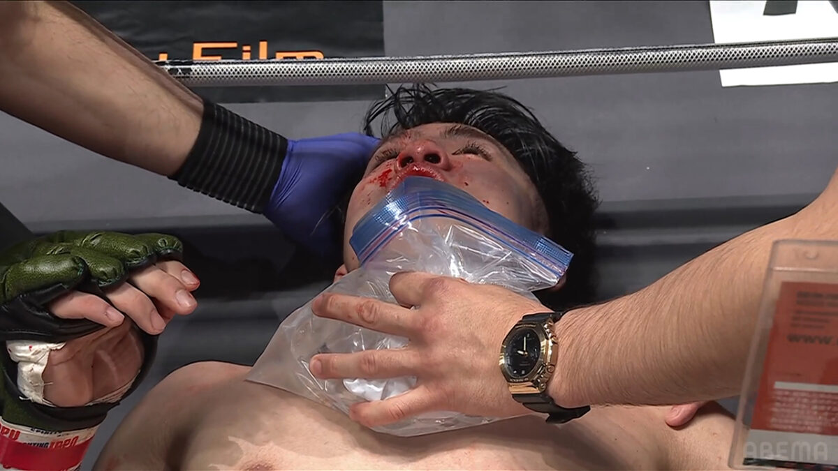 征矢貴 vs. トニー・ララミー 勝者トニーララミー 3R TKO